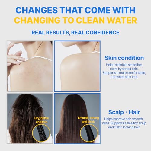 Showerhead Replacement Filters Inspired By Korea's Beauty Culture (5 Count)
